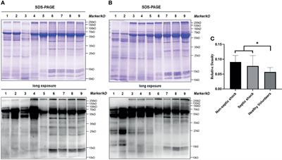 Lactylated Histone H3K18 as a Potential Biomarker for the Diagnosis and Predicting the Severity of Septic Shock